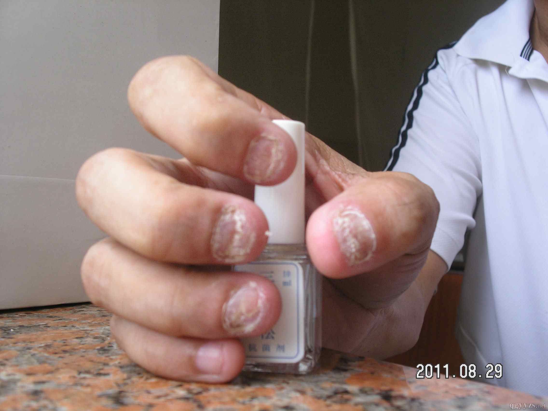 �������p��