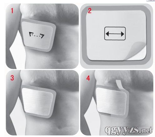 �ǿ��߹ǹ��ۊA��a(ch��n)Ʒ�DƬ