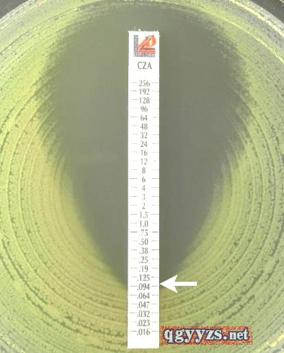 �^�����-���S��̹MIC�ݶȶ���ˎ��ԇ���l